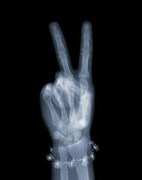 Peace with Daisies by Nick Veasey