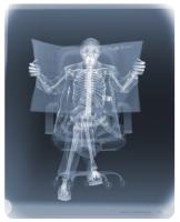 Examination of Newspaper Man by Nick Veasey