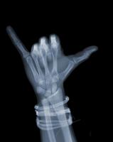 Hang Loose with Bands by Nick Veasey