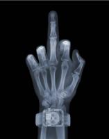 Finger with Watch by Nick Veasey